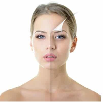 How-Much-Does-Microneedling-Cost-in-New-York-City