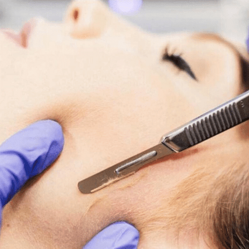 Dermaplaning New York City