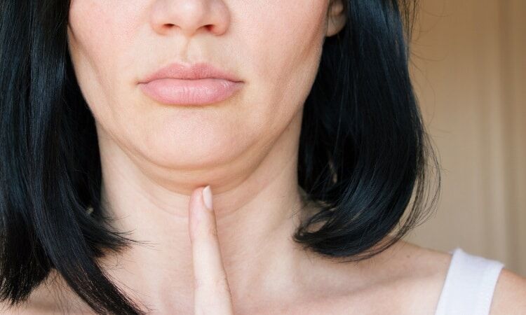 Kybella New York City