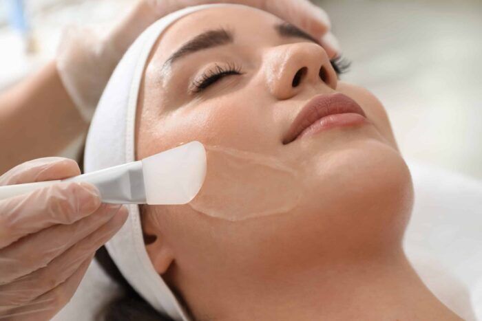 What Can Chemical Peels Do for Your Skin?